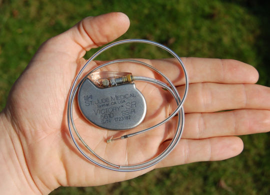 1200px-st_jude_medical_pacemaker_in_hand
